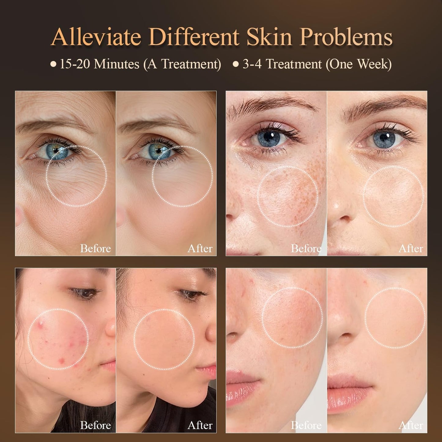 Showing MEGELIN 7 Color LED Light Therapy Face Mask results